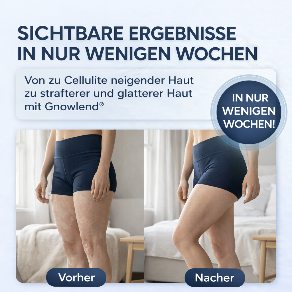 Gnowlend Pro Anti-Cellulite Vakuum Massagegerät